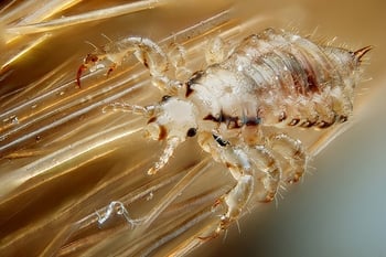 Head Lice Head Lice
